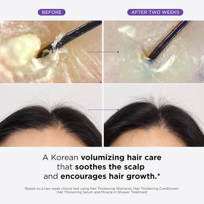 Dr. Groot Thickening Serum, Shampoo, Conditioner, and Scalp Treatment Set for Hair Loss - product detail image 3