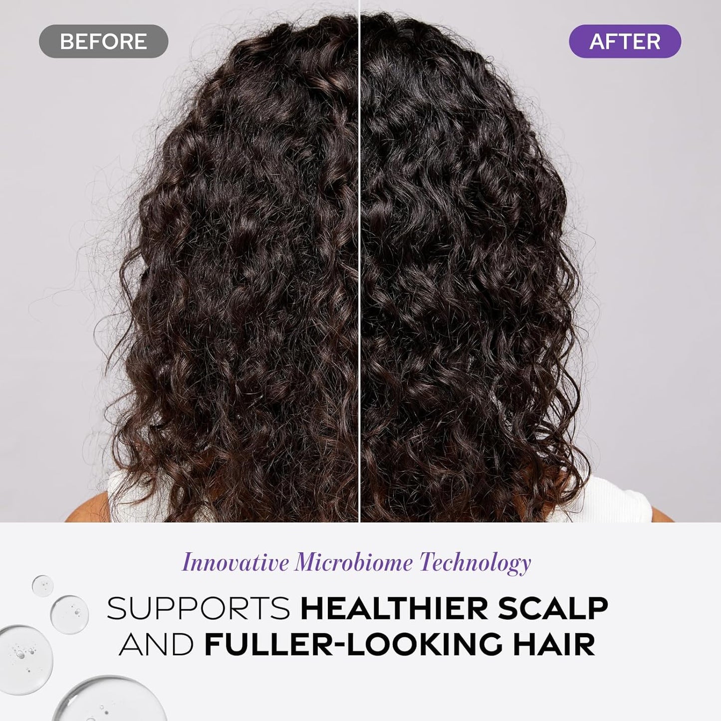 Dr. Groot Scalp Revitalizing Solution Scalp Exfoliating Detox Water - product detail image 6